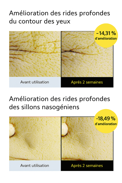 Rétinal Shot Booster