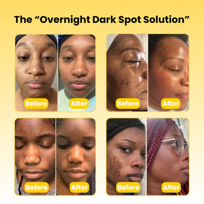 Radiance Reset Overnight Dark Spot Mask